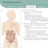 research project, endometriosis